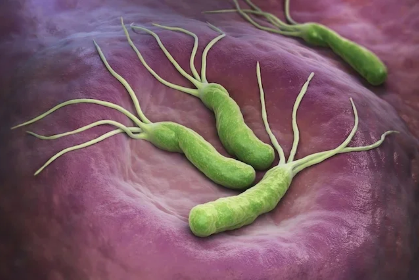 helicobacter pylori . test aliento lima , prueba aliento