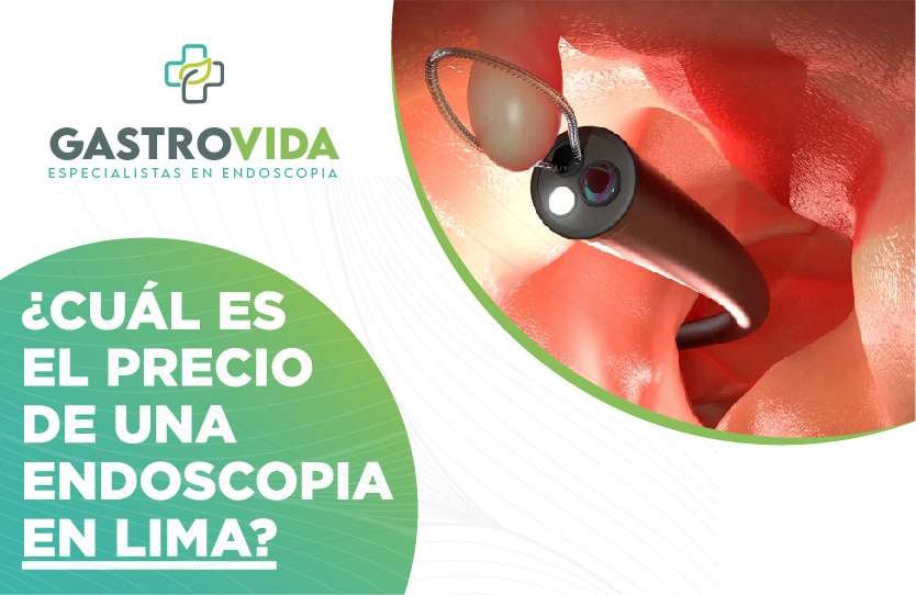 endoscopia-precio