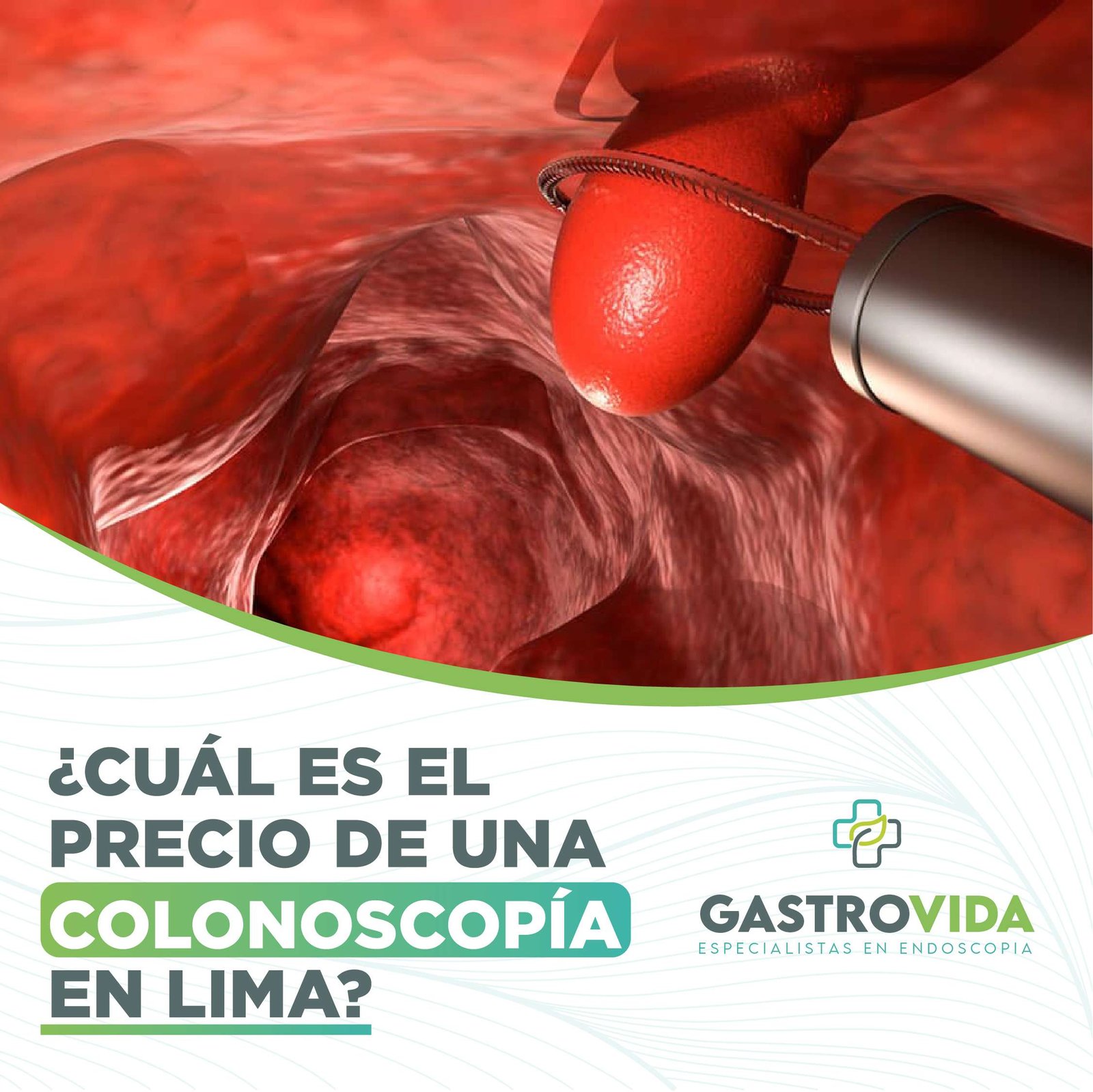 colonoscopia-precio