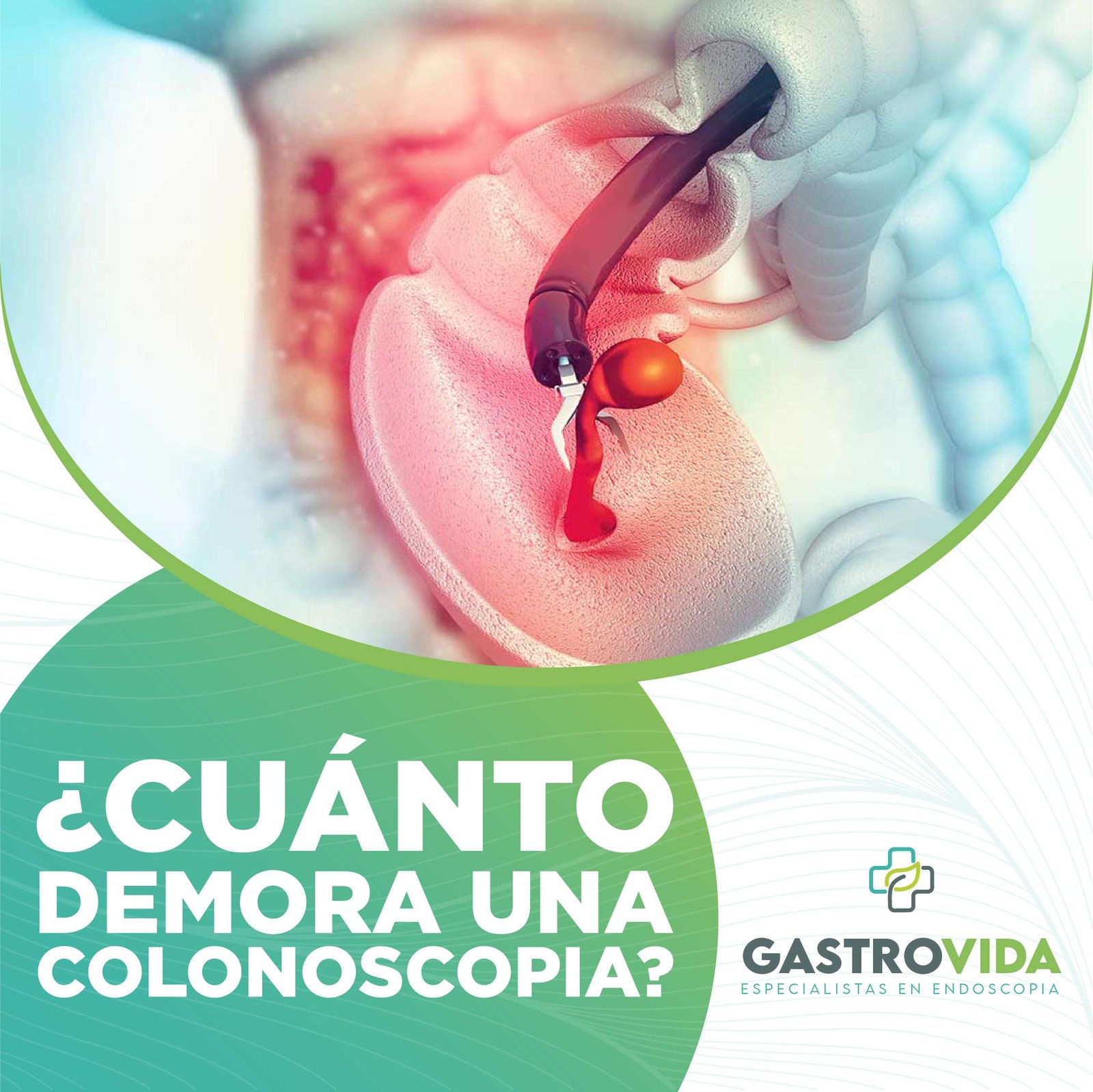 cuánto-demora-una-colonoscopia