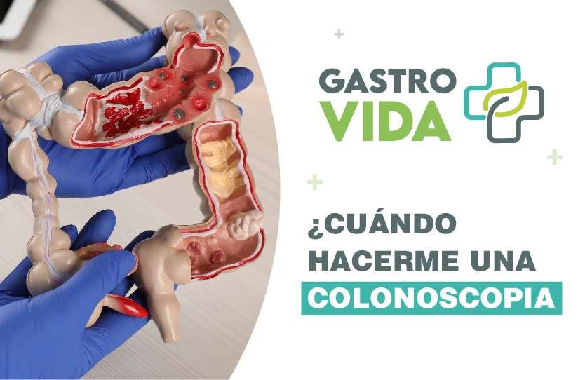 Cuando-hacerme-una-colonoscopia