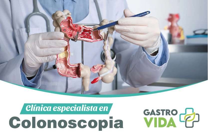 clinica-especialista-en-colonoscopia