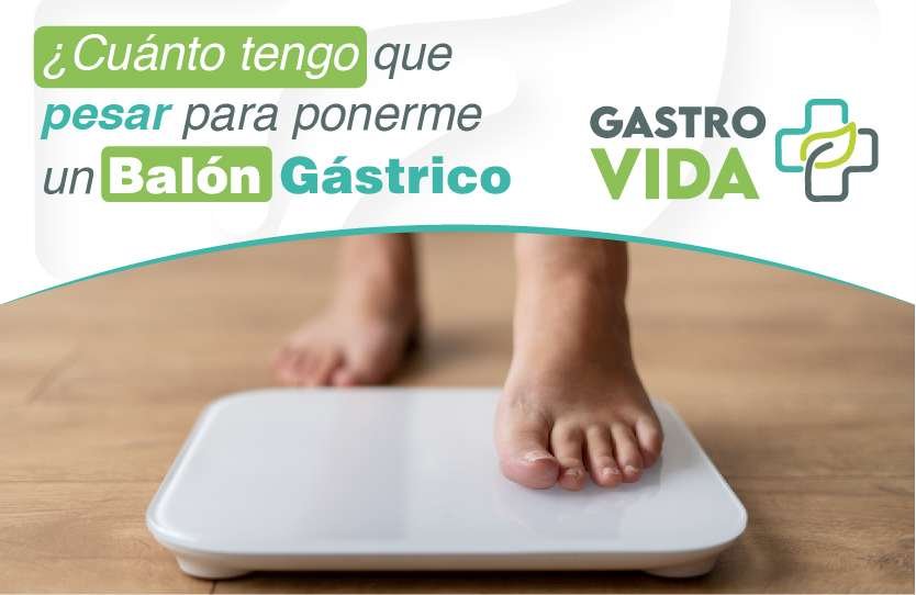 Cuanto debes pesar para ponerte el balón gástrico