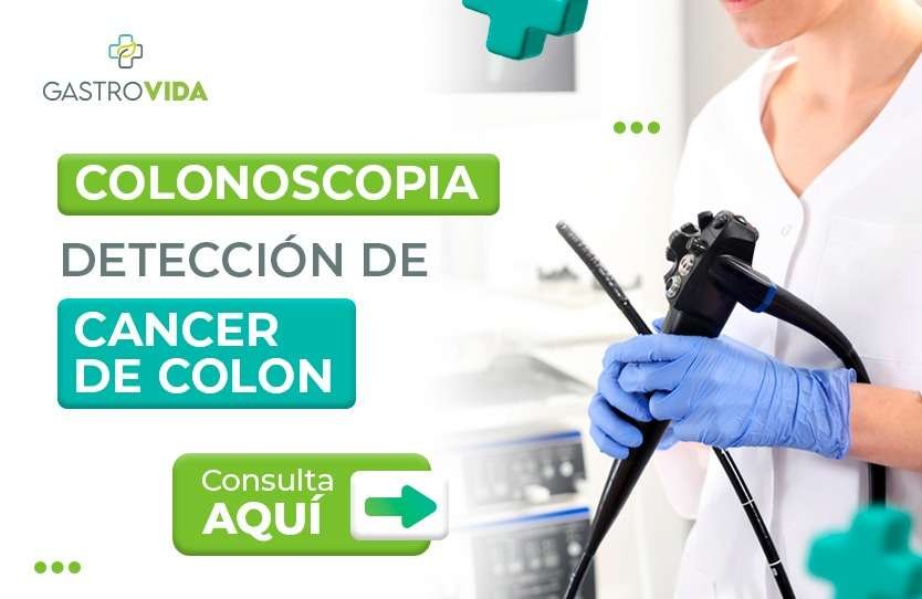Colonoscopia detección de cáncer de colon