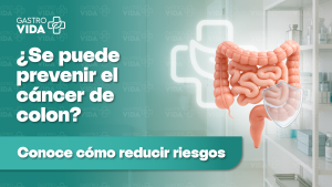¿Se puede prevenir el Cáncer de Colon?