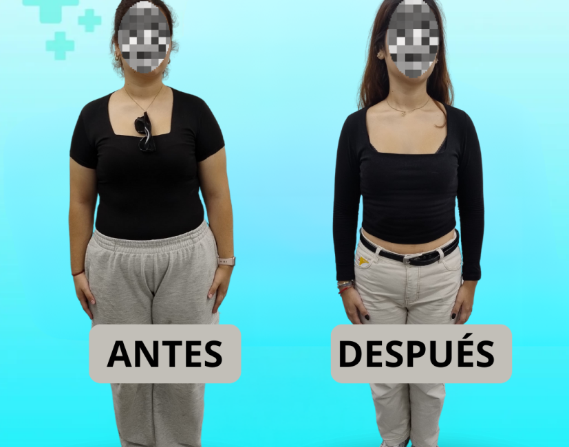 testimonio balon gastrico